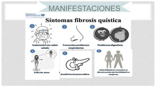MANIFESTACIONES
CLÍNICAS
 