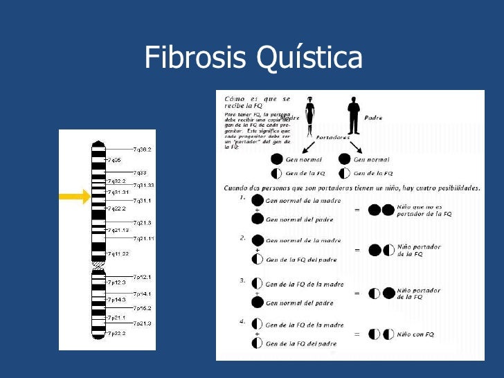 Fibrosis quística Fibrosis quística