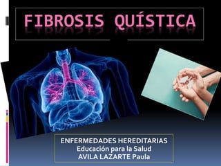 FIBROSIS QUÍSTICA
ENFERMEDADES HEREDITARIAS
Educación para la Salud
AVILA LAZARTE Paula
 