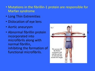 • Mutations in the fibrillin-1 protein are responsible for
Marfan syndrome
• Long Thin Extremities
• Dislocation of eye lens
• Aortic aneurysm
• Abnormal fibrillin protein is
incorporated into
microfibrils along with
normal fibrillin,
inhibiting the formation of
functional microfibrils.
 