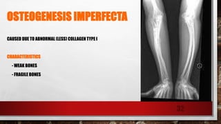 OSTEOGENESIS IMPERFECTA
CAUSED DUE TO ABNORMAL (LESS) COLLAGEN TYPE I
CHARACTERISTICS
- WEAK BONES
- FRAGILE BONES
32
 