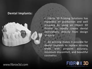 Dental Implants:
• Fibrox 3D Printing Solutions has
expanded its production and well
accuracy by using an Object 3D
Printer to rapidly create dental
restorations directly from design
imagery.
• 3D printing makes it possible for
dental implants to replace missing
teeth with pinpoint accuracy,
minimum discomfort, and beautiful
cosmetics.
www.fibrox3d.com
 