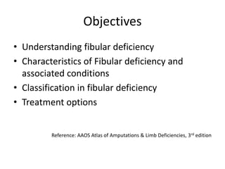 Fibular deficiency and management.pptx