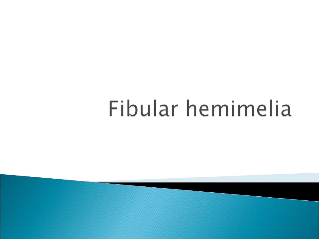 Fibular hemimelia