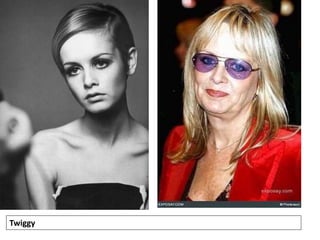 Twiggy
 