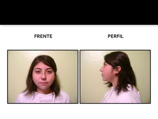 FRENTE PERFIL 