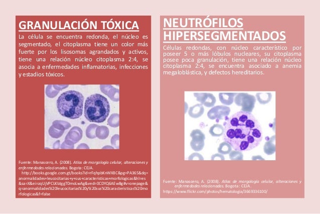 Que Significa Neutrofilos Con Granulaciones Toxicas