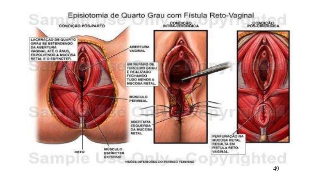 social perra vaginal social perra vaginal