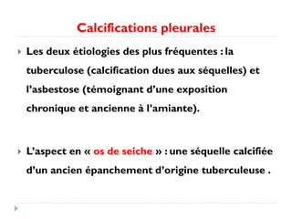 Calcifications pleurales
 Les deux étiologies des plus fréquentes : la
tuberculose (calcification dues aux séquelles) et
l’asbestose (témoignant d’une exposition
chronique et ancienne à l’amiante).
 L’aspect en « os de seiche » : une séquelle calcifiée
d’un ancien épanchement d’origine tuberculeuse .
 
