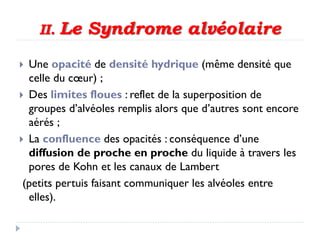 II. Le Syndrome alvéolaire
 Une opacité de densité hydrique (même densité que
celle du cœur) ;
 Des limites floues : reflet de la superposition de
groupes d’alvéoles remplis alors que d’autres sont encore
aérés ;
 La confluence des opacités : conséquence d’une
diffusion de proche en proche du liquide à travers les
pores de Kohn et les canaux de Lambert
(petits pertuis faisant communiquer les alvéoles entre
elles).
 