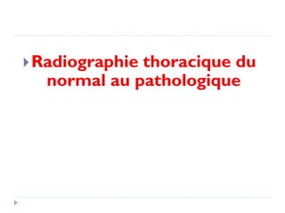 Radiographie thoracique du
normal au pathologique
 