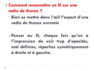  Comment reconnaitre un SI sur une
radio de thorax ?
1.Bien se mettre dans l’œil l’aspect d’une
radio de thorax normale
2.Penser au SI, chaque fois qu’on a
l’impression de voir trop d’opacités,
mal définies, réparties symétriquement
à droite et à gauche.
 