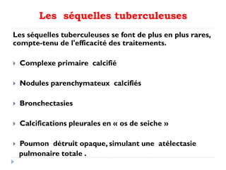 Les séquelles tuberculeuses
Les séquelles tuberculeuses se font de plus en plus rares,
compte-tenu de l'efficacité des traitements.
 Complexe primaire calcifié
 Nodules parenchymateux calcifiés
 Bronchectasies
 Calcifications pleurales en « os de seiche »
 Poumon détruit opaque, simulant une atélectasie
pulmonaire totale .
 