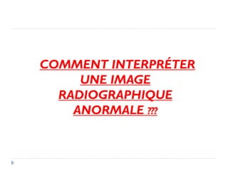 COMMENT INTERPRÉTER
UNE IMAGE
RADIOGRAPHIQUE
ANORMALE ???
 