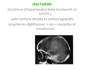 chez l’adulte
Syndrome d’hypertension intra cranienne( Sd
D’HTIC )
selle turcique érodée et surtout agrandie
empreintes digitiformes + ou – marquées et
nombreuses
 