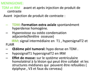 MENINGIOME:
TDM et IRM avant et après injection de produit de
contraste
Avant injection de produit de contraste :
– TDM: Formation extra axiale spontanément
hyperdense homogène.
– Hyperostose ou ostéo condensation
adjacente(fenêtre osseuse)
IRM: signal intermédiaire en T1 , hypersignalT2 et
FLAIR
– Œdème péri tumoral: hypo dense en TDM .
– hyposignalT1 hypersignalT2 en IRM
– Effet de masse: sur le système ventriculaire
homolatéral à la lésion qui peut être collabé et les
structures médianes qui peuvent être refoulées (
épiphyse , V3 et faux du cerveau)
 