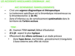 LES ACCIDENTS VASCULAIRES CEREBRAUX : AVC
• AVC ISCHEMIQUE: RAMOLLISSEMENT:
– C’est une urgence diagnostique et thérapeutique
– Le traitement spécifique est la thrombolyse intraveineuse ou
la thrombectomie (- de 4h)
– Zone d’infarctus ou de ramolissement systématisée dans le
territoire de l’artère occluse
TDM :
– J1 : Examen TDM normal /début d’évolution
– J2 à j8 : aspect le plus typique
– Effacement des sillons corticaux à un stade précoce
• Zone hypo dense ,mal limitée , grossièrement triangulaire
à base externe avec effet de masse
 
