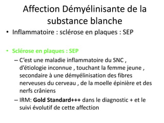 Affection Démyélinisante de la
substance blanche
• Inflammatoire : sclérose en plaques : SEP
• Sclérose en plaques : SEP
– C’est une maladie inflammatoire du SNC ,
d’étiologie inconnue , touchant la femme jeune ,
secondaire à une démyélinisation des fibres
nerveuses du cerveau , de la moelle épinière et des
nerfs crâniens
– IRM: Gold Standard+++ dans le diagnostic + et le
suivi évolutif de cette affection
 