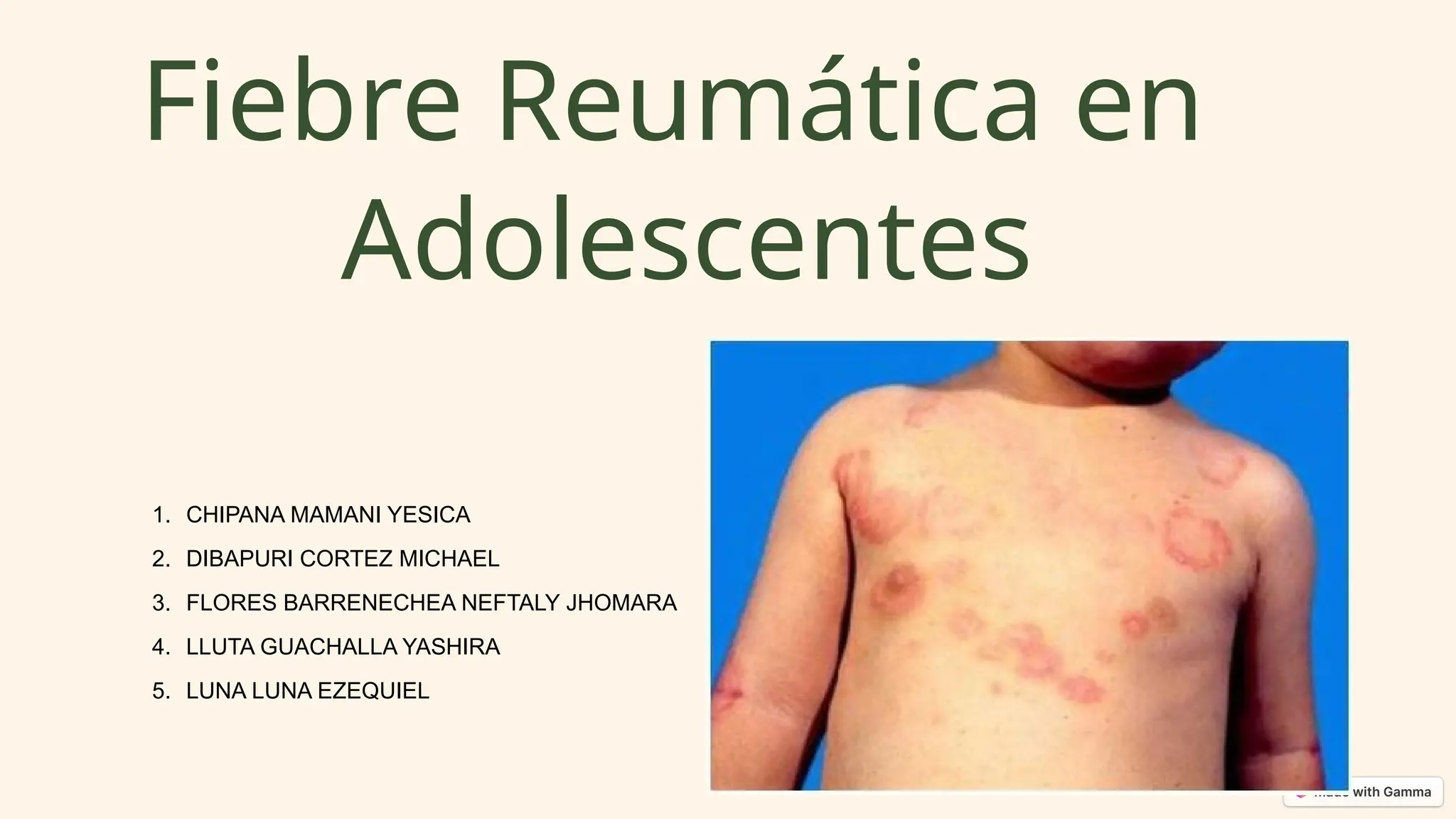 Fiebre-Reumatica-en-Adolescentes-Diagnostico-Tratamiento-y-Prevencion.pptx
