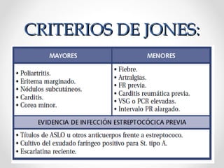 CRITERIOS DE JONES:CRITERIOS DE JONES:
 