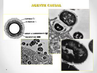 AGENTE CAUSALAGENTE CAUSAL
 