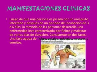 MANIFESTACIONES CLINICASLuego de que una persona es picada por un mosquito infectado y después de un período de incubación de 3 a 6 días, la mayoría de las personas desarrolla una enfermedad leve caracterizada por fiebre y malestar de varios días de duración. Consistente en dos fases: Una fase aguda de fiebre, cefalea, mialgias, nauseas y vómitos. 