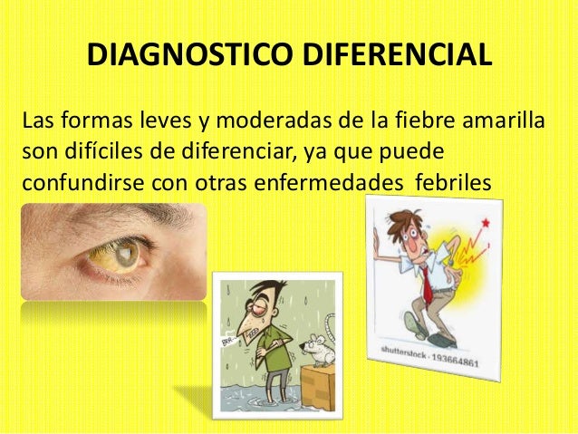 signos y sintomas de fiebre amarilla signos y sintomas de fiebre amarilla