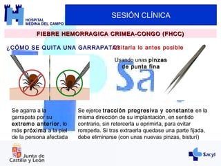 SESIÓN CLÍNICA
FIEBRE HEMORRAGICA CRIMEA-CONGO (FHCC)FIEBRE HEMORRAGICA CRIMEA-CONGO (FHCC)
¿CÓMO SE QUITA UNA GARRAPATA?Quitarla lo antes posible
Usando unas pinzaspinzas
de punta finade punta fina
Se ejerce tracción progresiva y constante en la
misma dirección de su implantación, en sentido
contrario, sin retorcerla u oprimirla, para evitar
romperla. Si tras extraerla quedase una parte fijada,
debe eliminarse (con unas nuevas pinzas, bisturí)
Se agarra a la
garrapata por su
extremo anterior, lo
más próxima a la piel
de la persona afectada
 
