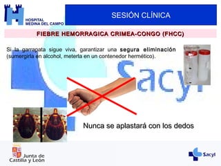 SESIÓN CLÍNICA
FIEBRE HEMORRAGICA CRIMEA-CONGO (FHCC)FIEBRE HEMORRAGICA CRIMEA-CONGO (FHCC)
Si la garrapata sigue viva, garantizar una segura eliminación
(sumergirla en alcohol, meterla en un contenedor hermético).
Nunca se aplastará con los dedosNunca se aplastará con los dedos
 