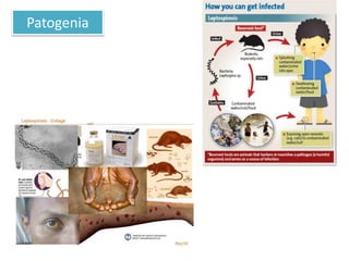 Patogenia
 