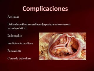 Arritmias

Daño a las válvulas cardíacas (especialmente estenosis
mitral y aórtica)

Endocarditis

Insuficiencia cardíaca

Pericarditis

Corea de Sydenham
 