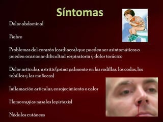 Dolor abdominal

Fiebre

Problemas del corazón (cardíacos) que pueden ser asintomáticos o
pueden ocasionar dificultad respiratoria y dolor torácico

Dolor articular, artritis (principalmente en las rodillas, los codos, los
tobillos y las muñecas)

Inflamación articular, enrojecimiento o calor

Hemorragias nasales (epistaxis)

Nódulos cutáneos
 