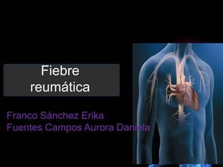 Fiebre
reumática
Franco Sánchez Erika
Fuentes Campos Aurora Daniela
 
