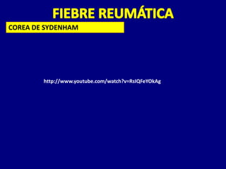 COREA DE SYDENHAM




        http://www.youtube.com/watch?v=RsIQFeYOkAg
 
