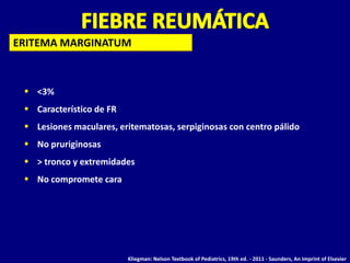 ERITEMA MARGINATUM



  <3%
  Característico de FR
  Lesiones maculares, eritematosas, serpiginosas con centro pálido
  No pruriginosas
  > tronco y extremidades
  No compromete cara




                          Kliegman: Nelson Textbook of Pediatrics, 19th ed. - 2011 - Saunders, An Imprint of Elsevier
 