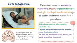 Fiebre Reumática en pediatría según aeped.pptx