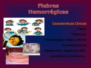Características Clínicas
                       · Fiebre
                   · Petequias
· Hemorragias, nasal y uterina
            · Trombocitopenia
· Hipotensión, signos del SNC,
     leucopenia, proteinuria...
 