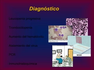 Diagnóstico
Leucopenia progresiva

Trombocitopenia

Aumento del hematócrito

Aislamiento del virus

PCR

Inmunohistoquímica
 