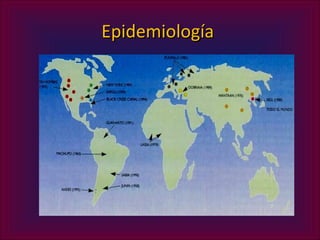 Epidemiología
 