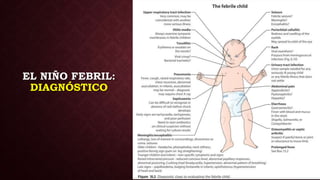 EL NIÑO FEBRIL:
DIAGNÓSTICO
 
