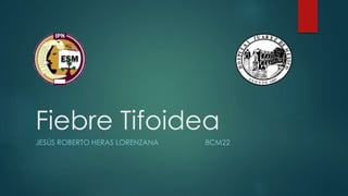 Fiebre Tifoidea
JESÚS ROBERTO HERAS LORENZANA 8CM22
 