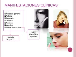 Regeneración *Intervalos semanales