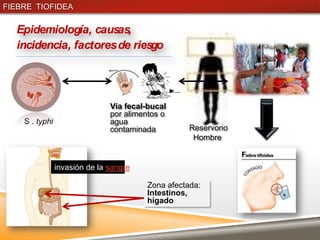 FIEBRE TIOFIDEA

  Epidemiología, causas,
  incidencia, factores de riesgo




                               Vía fecal-bucal
                               por alimentos o
    S . typhi                  agua
                               contaminada         Reservorio
                                                    Hombre


                invasión de la sangre

                                        Zona afectada:
                                        Intestinos,
                                        hígado
 