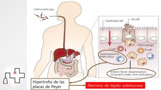 Hipertrofia de las
placas de Peyer Necrosis de tejido submucoso
 