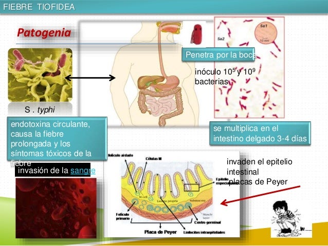 FIEBRE TIFOIDEA