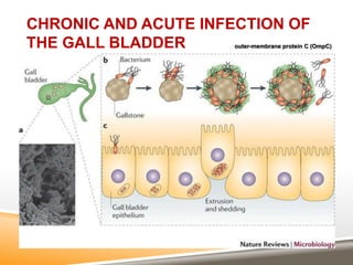 CHRONIC AND ACUTE INFECTION OF
THE GALL BLADDER outer-membrane protein C (OmpC)
 