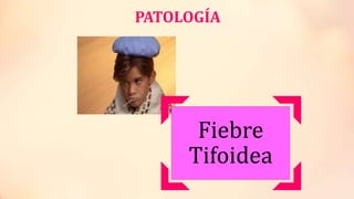 PATOLOGÍA
Fiebre
Tifoidea
 