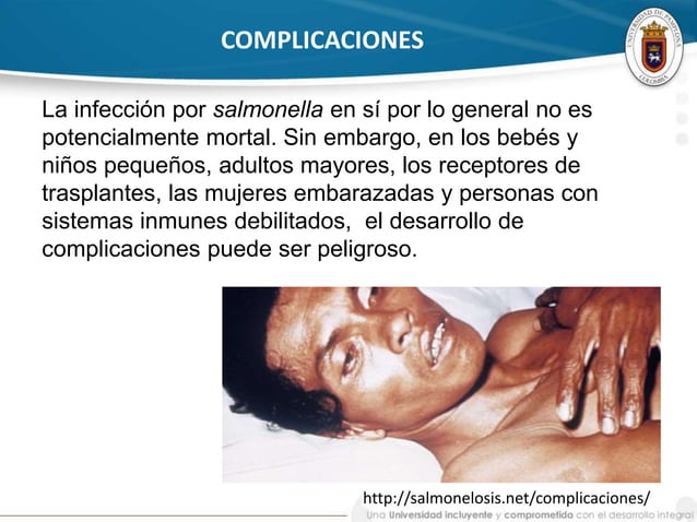 Fiebre tifoidea y paratifoidea