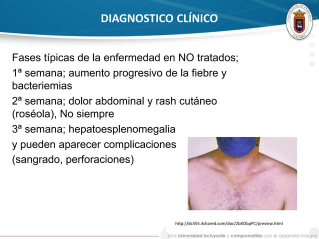 Fiebre tifoidea y paratifoidea