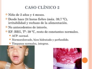 CASO CLÍNICO 2
GINGIVOESTOMATITIS HERPÉTICA
 Está producida por el VHS-1.
 La primoinfección es asintomática en el 95 % ...
